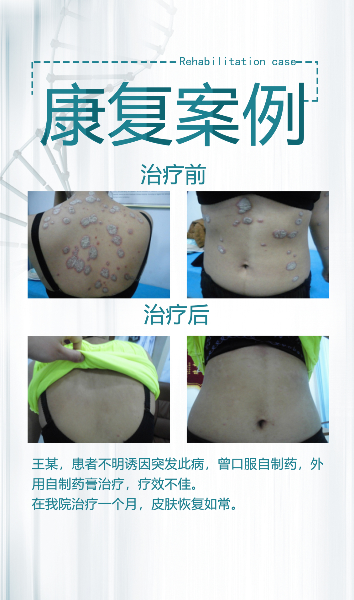 淘宝美工浅淡的风医院装饰展板作品