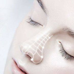 动态仿生综合隆鼻术