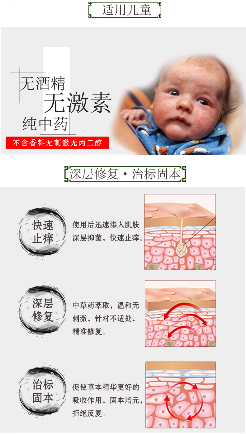 淘宝美工浅淡的风婴儿皮炎湿疹详情页作品