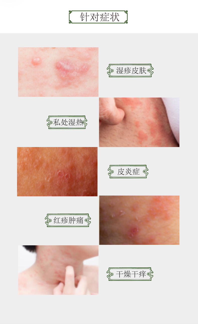 淘宝美工浅淡的风婴儿皮炎湿疹详情页作品